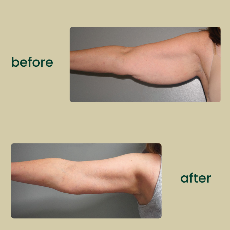 organic lymphatic drainage drops