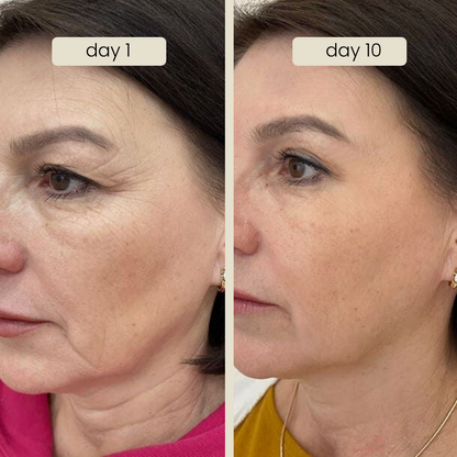 seoul - 4% retinal liposome treatment